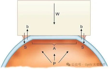眼压测量示意图